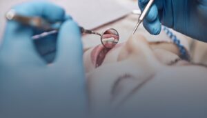 Dental examination